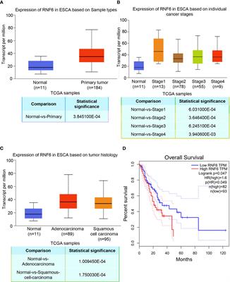 RNF6 activates TGF-β1/c-Myb pathway to promote EMT in esophageal squamous cell carcinoma